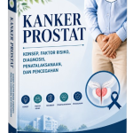 KANKER PROSTAT: KONSEP, FAKTOR RISIKO, DIAGNOSIS, PENATALAKSANAAN, DAN PENCEGAHAN